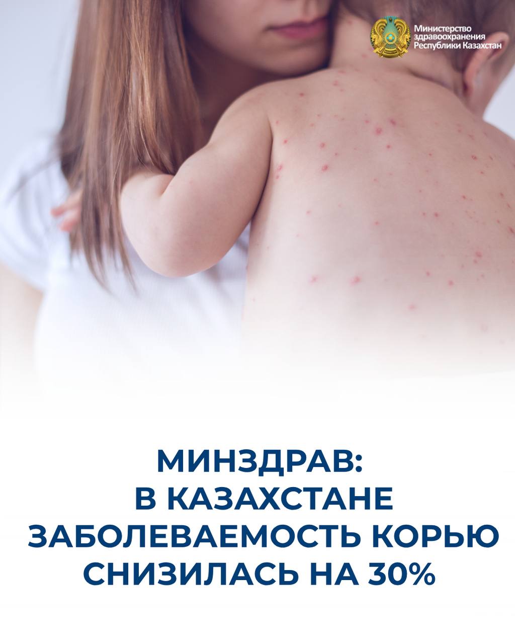 МИНЗДРАВ: В КАЗАХСТАНЕ ЗАБОЛЕВАЕМОСТЬ КОРЬЮ СНИЗИЛАСЬ НА 30%