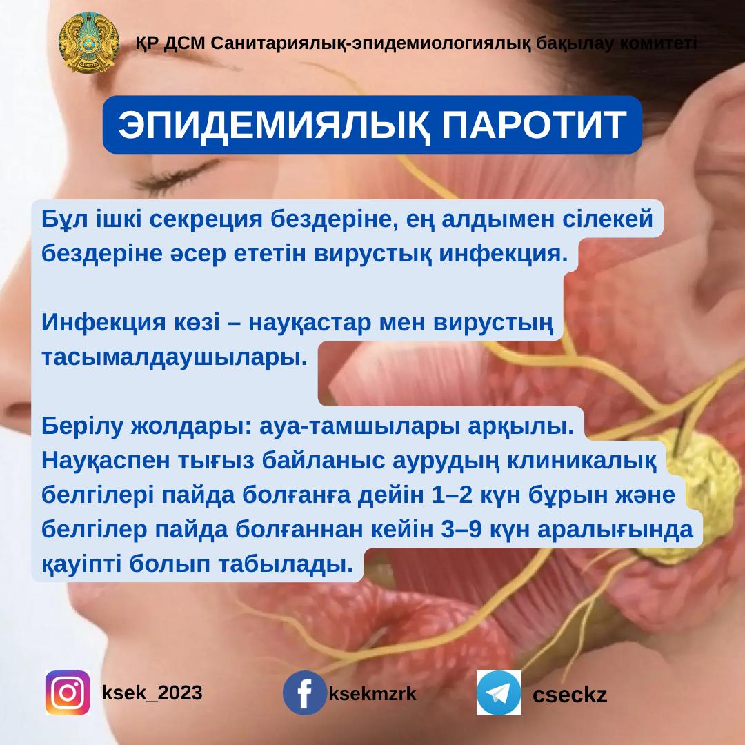 Эпидемиялық паротит