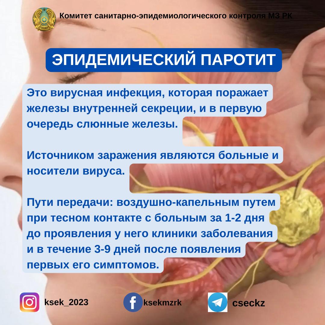 Эпидемический паротит