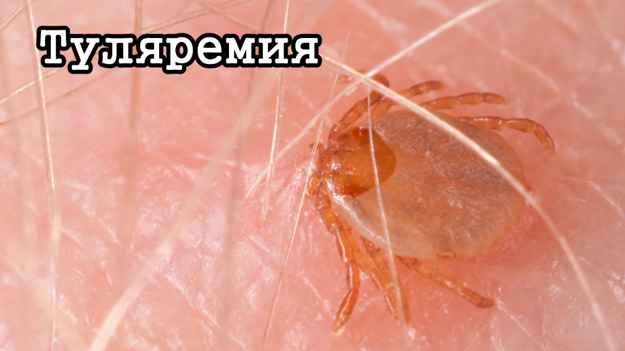 Абайланыз, туляремия!