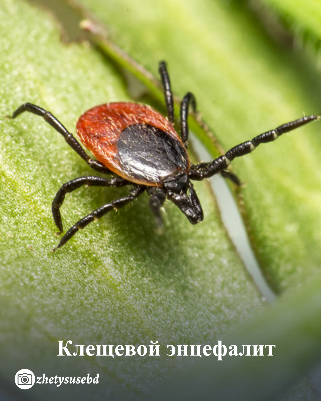 Клещевой энцефалит