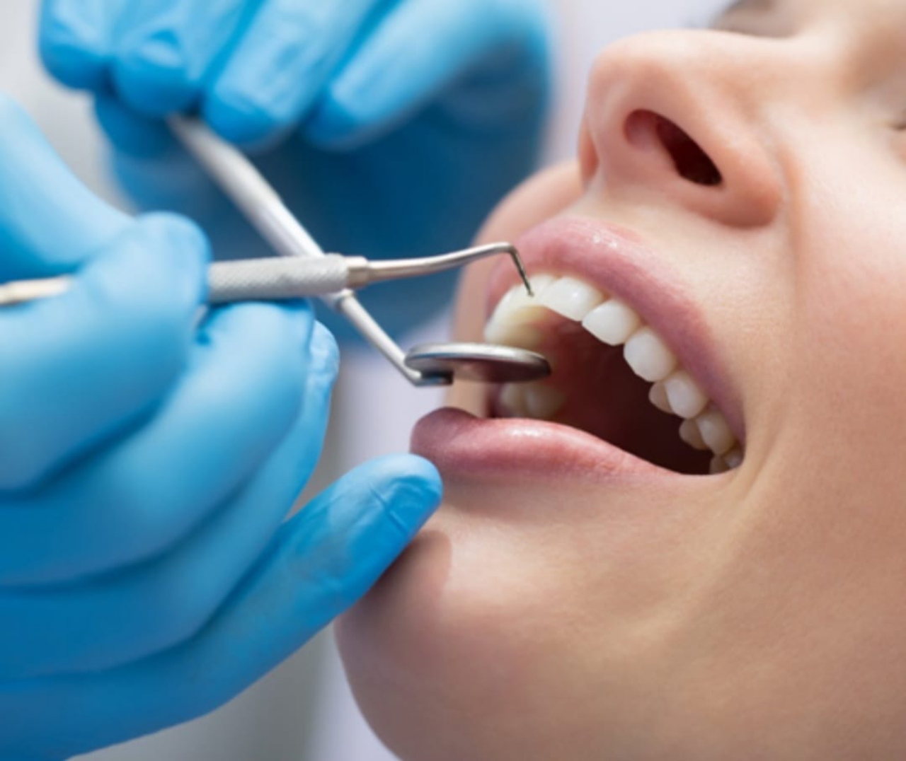 Гарантия на словах: как стоматология отказалась отвечать за некачественную услугу