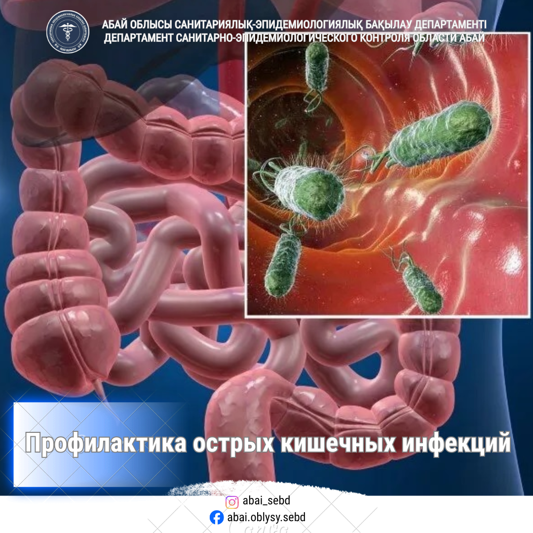 Профилактика острых кишечных инфекций