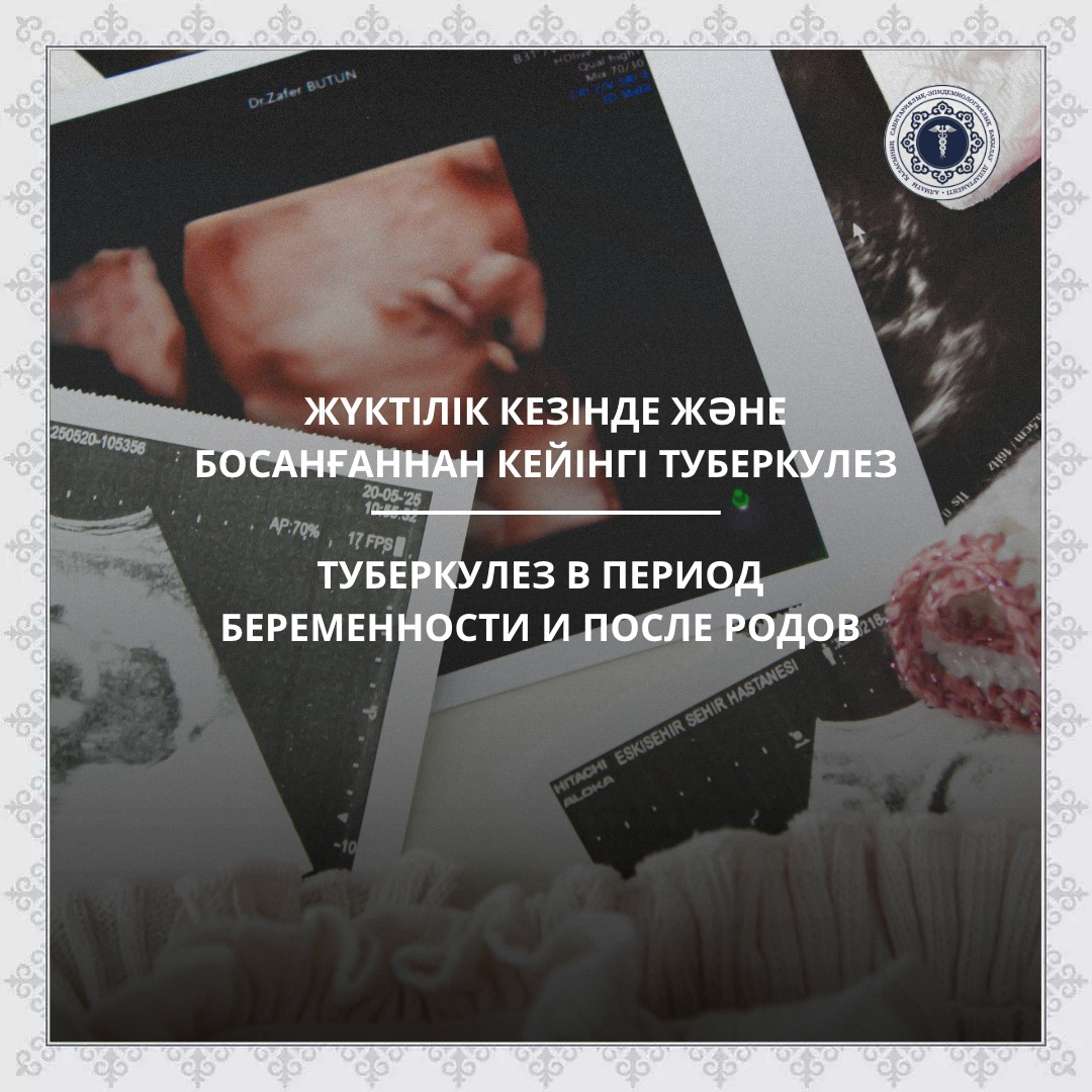 Туберкулез в период беременности и после родов